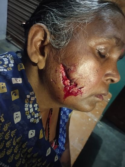 Ayodhya News: Woman was going to watch Durga Puja, when suddenly she was attacked by a wolf